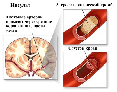 риск