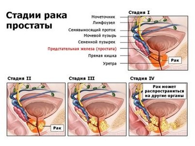 риск