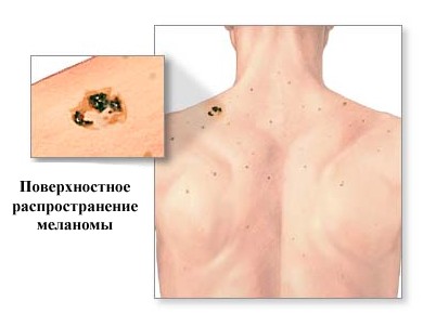 после после